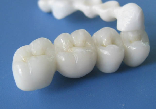 第Ⅱ類醫(yī)療器械“定制式義齒”產(chǎn)品的注冊(cè)申報(bào)資料要求及審評(píng)共性問(wèn)題分享(圖1)