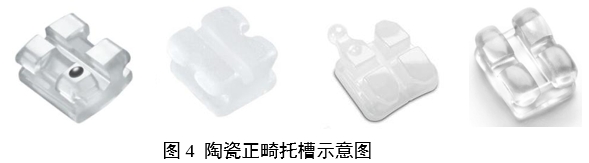 正畸托槽注冊(cè)審查指導(dǎo)原則（2022年第41號(hào)）(圖4)
