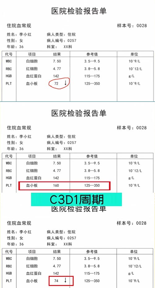 AE與研究藥物關(guān)系記錄不一致，如何處理？